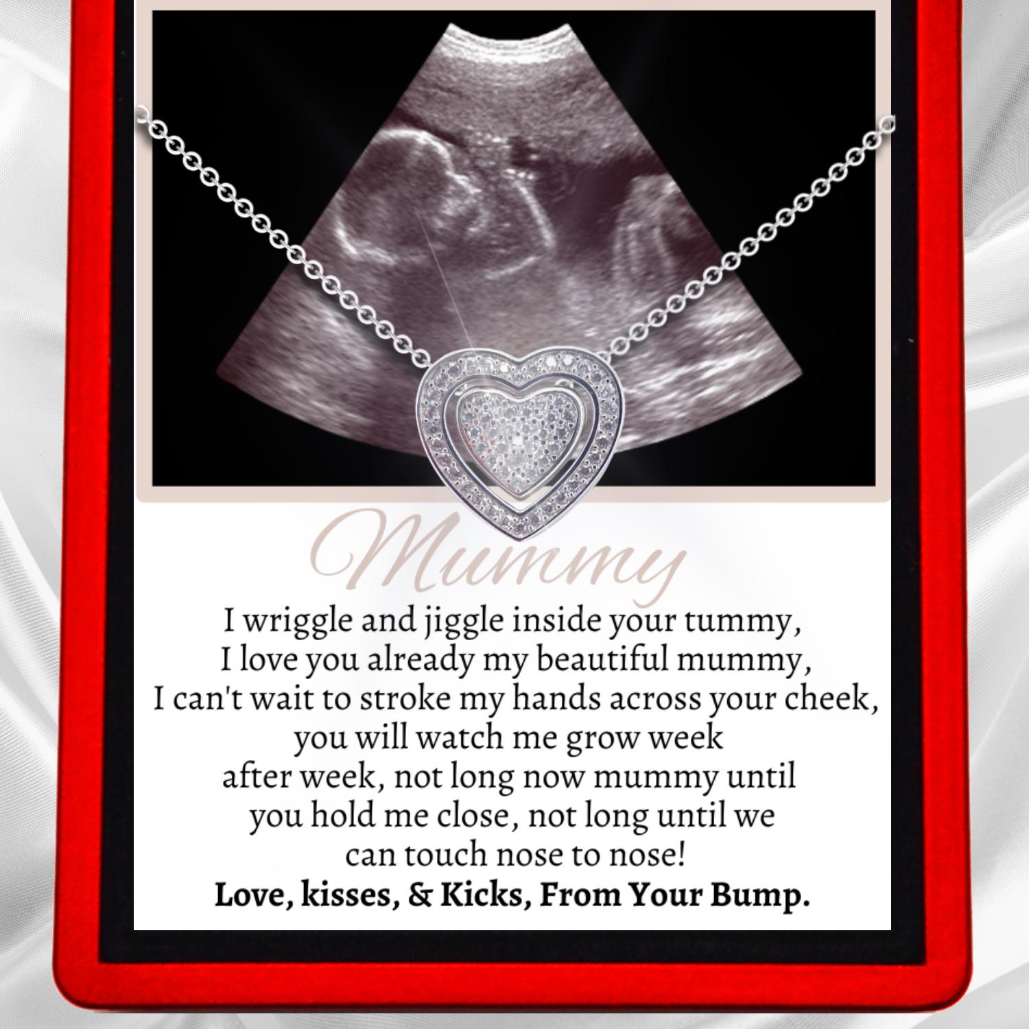 Ultrasound "Mummy To be" Love Heart Trinity Necklace 3 in 1 - MummyScan